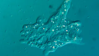 Эти амёбы — тихая угроза, которая подкрадывается через воду и почву: почему мир должен насторожиться