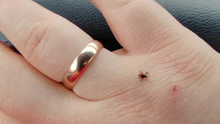 Клещи ненавидят этот запах: стоит копейки, а защищает в сто раз лучше магазинного аэрозоля