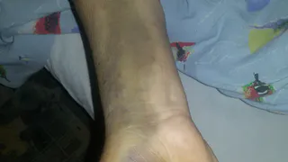 Пожилой рязанец, которого сбила машина, потерял здоровье, а водитель даже не извинился