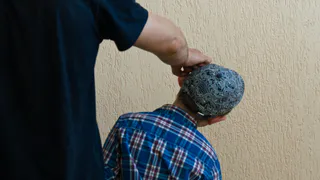 В Рязанской семинарии после драки первокурснику наложили 22 шва