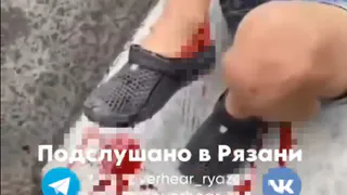 В Рязани на Лыбедском бульваре ребенок получил перелом ноги