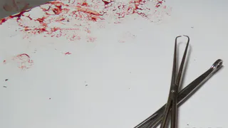 Женщина из Рязани пожаловалась, что ей удалили почку вместо опухоли