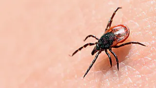 Будьте внимательны: в Рязанской области пострадали 22 человека от укусов клещей