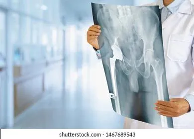 «Мясо все-таки надо есть»: Николай Дроздов объяснил причину многочисленных переломов