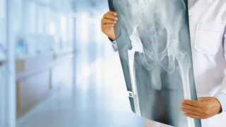 «Мясо все-таки надо есть»: Николай Дроздов объяснил причину многочисленных переломов