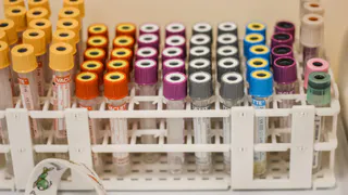 Рязанские "коронавирусные" анализы перестанут отправлять в Москву: выявлять больных будут быстрее