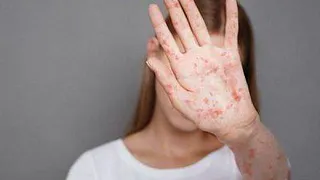 Врач-инфекционист предупредил о риске менингококковой инфекции в Пензенской области