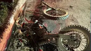 Питбайк вспыхнул как факел: подросток в больнице после ДТП в Челнах