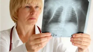 В Нижнекамске выявили 20 больных туберкулезом