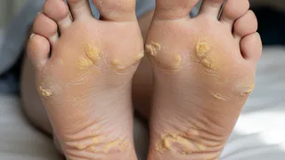 Никаких лезвий и пемз: мастер педикюра рассказала, как правильно ухаживать за пятками - будут как у младенца