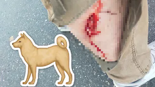 В мэрии заявили, что отыщут собаку, которая покусала рязанца на Таможне