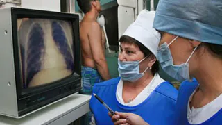 В Нижнекамске обсудили вопросы заболеваемости туберкулезом