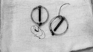 Жительница Рязани забыла о 25-летней внутриматочной спирали и родила