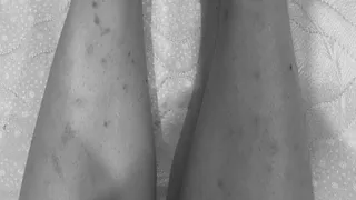 "По колено ноги искусаны": Жители Рязани страдают от блох в квартирах