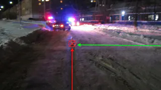 «Сотрясение и переломы»: в Коми пьяный водитель сбил женщину