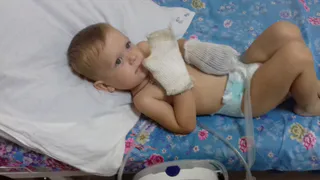 Мальчику, которому сожгло руки током под Рязанью, будут каждый год пересаживать кожу