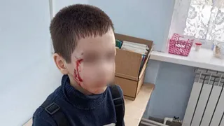 Бродячая собака набросилась на ребенка в Челябинской области: прокуратура требует наказать виновных и компенсировать вред