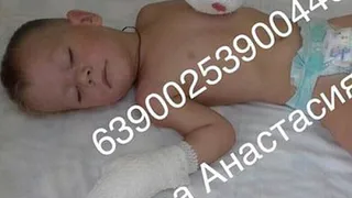 Мама мальчика, которому сожгло руки током под Рязанью, рассказала о случившемся