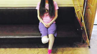 «Я стала пленницей своего тела» - 32-летняя рязанка осталась без ноги из-за перелома