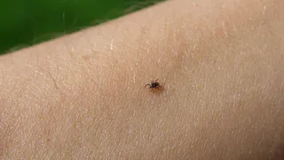 В лес без этого — ни ногой! 1 моток — и ни один клещ не пролезет