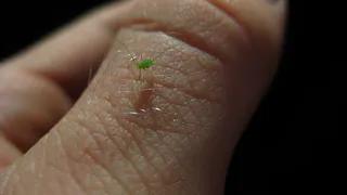 Горчица против тли: рабочий способ защиты смородины