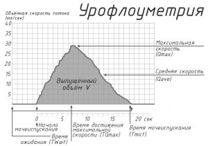 Урофлоуметрия, главная иллюстрация, общая схема.jpg