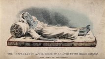 Жертва холеры в Сандерленде в 1832 году. Цветная литография