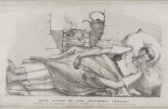Синяя стадия спастической холеры девочки, которая умирает в Сандерленде, ноябрь 1831