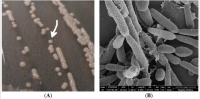 Candida-parapsilosis-An-Overview.png