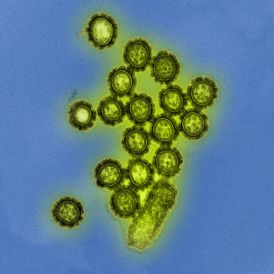 H1N1 Influenza Virus Particles (8411599236).jpg