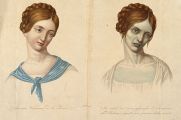Молодая женщина из Вены, умершая от холеры, изображена здоровой и за четыре часа до смерти. Цветная гравировка, 1831 год