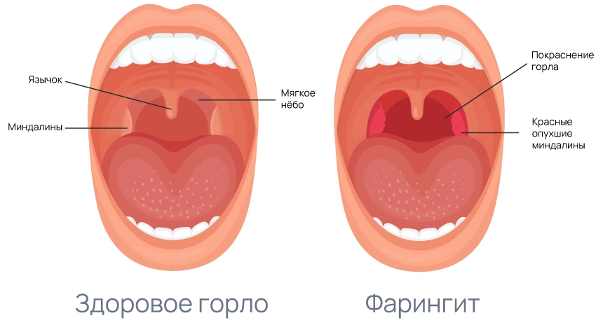 Симптомы отека ног