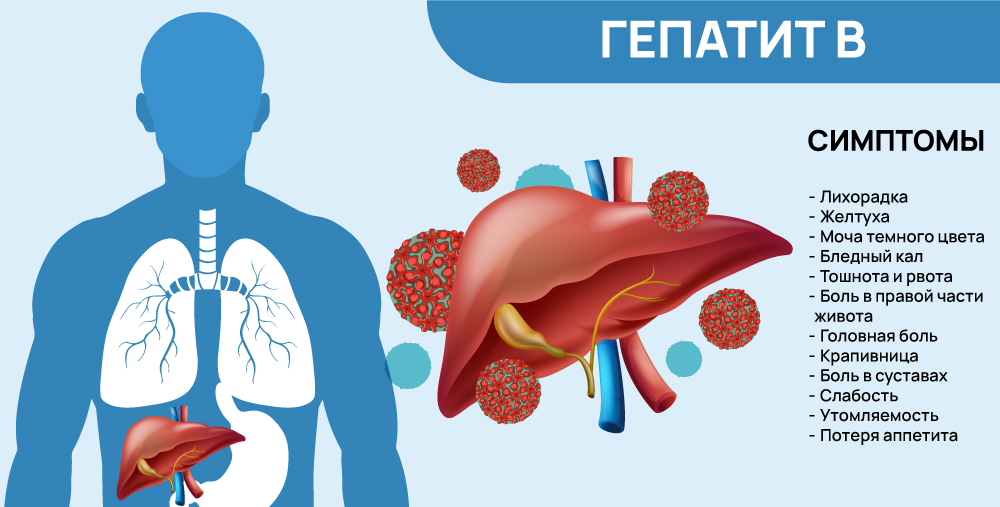Симптомы гепатита B