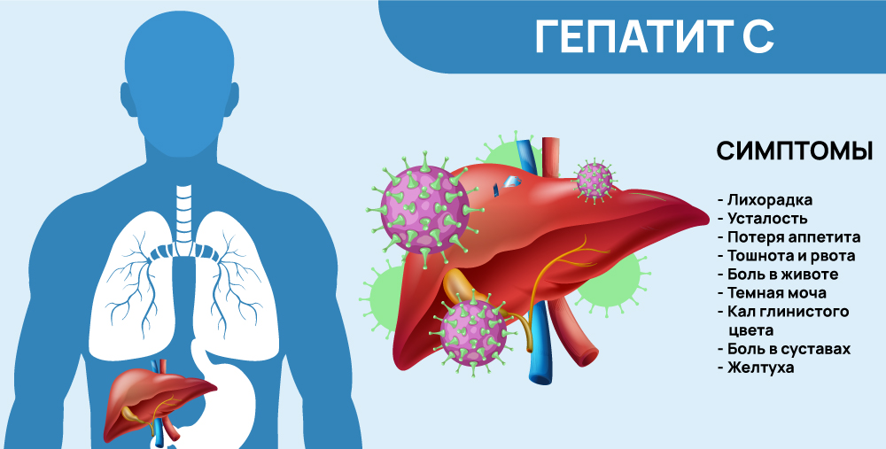 Симптомы гепатита C
