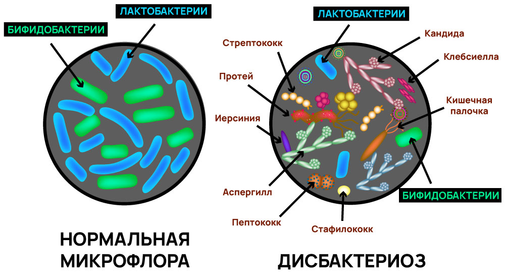 Бактерии в кишечники