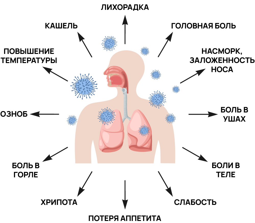 Симптомы ОРВИ