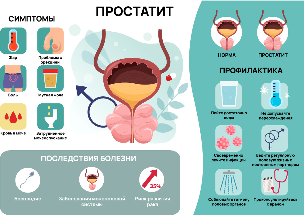 Простатит у мужчин