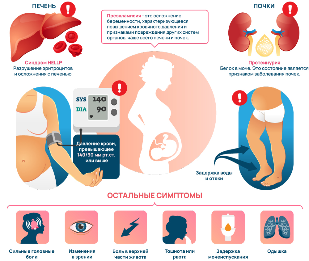 Симптомы преэклампсии