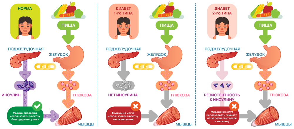 Механизм диабета