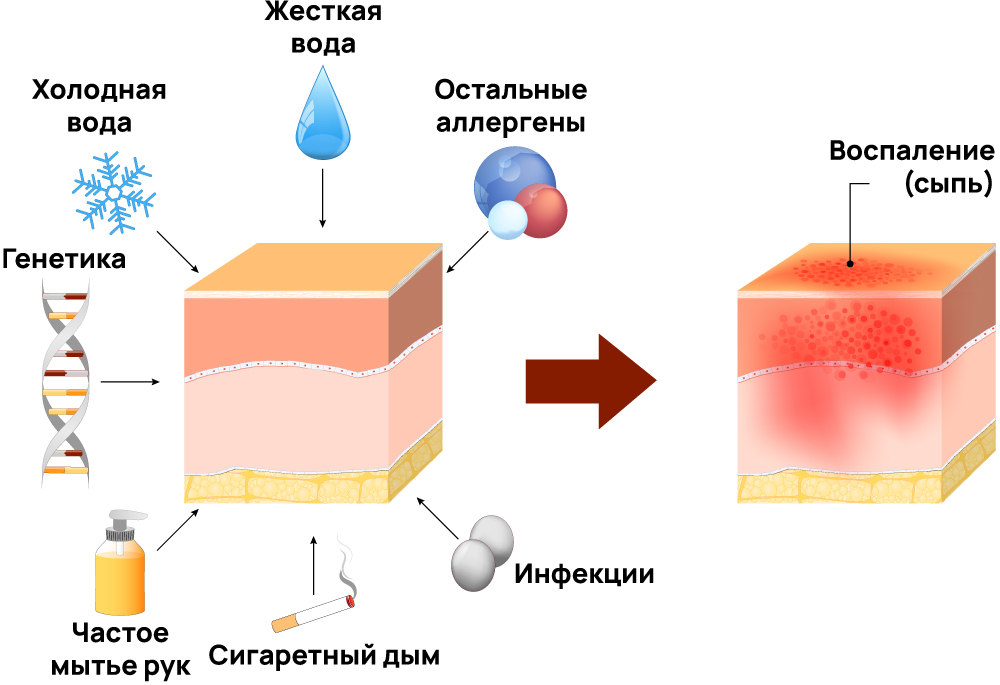 От чего появляется дерматит