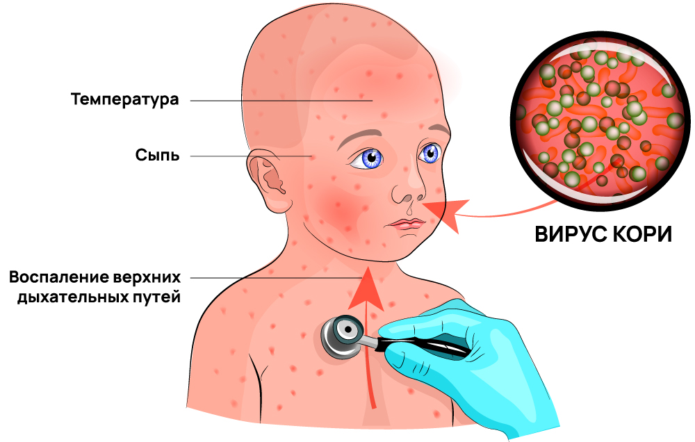 Вирус кори