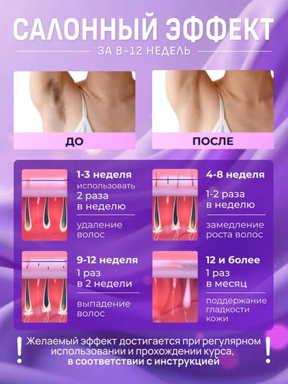 Babyverse SE7 – Og‘riqsiz, xavfsiz va samarali lazer epilyator - 4