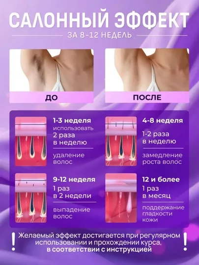 Babyverse SE7 – Безболезненный, безопасный и эффективный лазерный эпилятор
