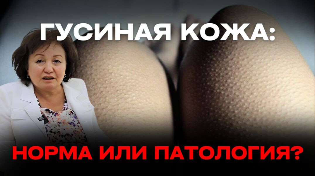 ГУСИНАЯ КОЖА: НОРМА ИЛИ ПАТОЛОГИЯ?