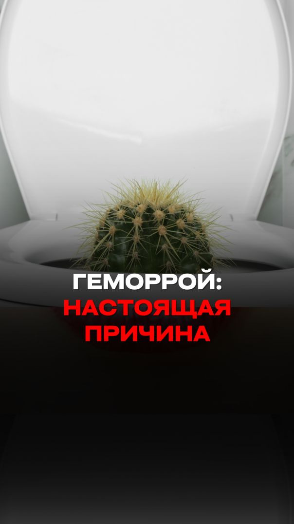 ГЕМОРРОЙ: НАСТОЯЩАЯ ПРИЧИНА Тизер