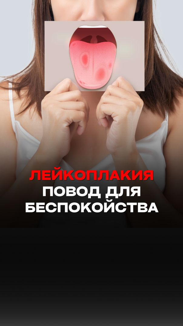 ЛЕЙКОПЛАКИЯ ПОВОД ДЛЯ БЕСПОКОЙСТВА Тизер