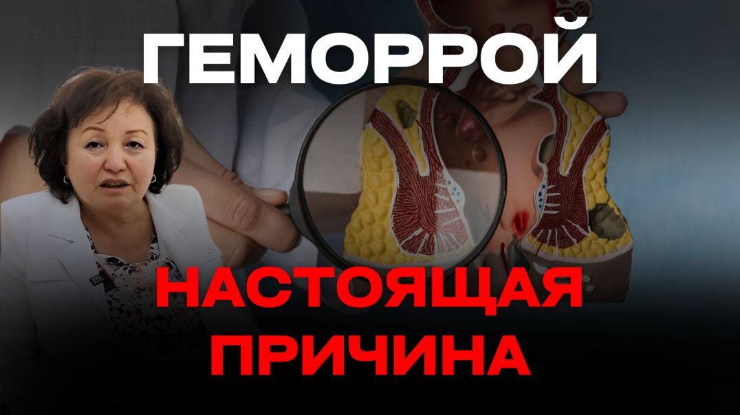 ГЕМОРРОЙ: НАСТОЯЩАЯ ПРИЧИНА