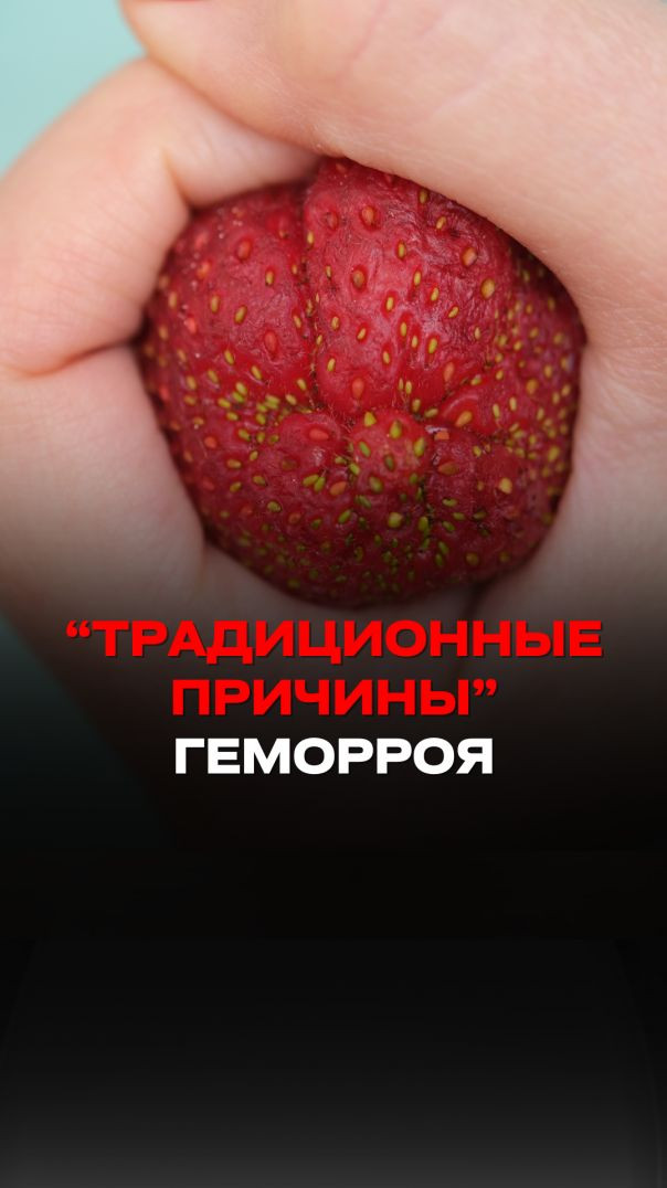 "ТРАДИЦИОННЫЕ ПРИЧИНЫ" ГЕМОРРОЯ