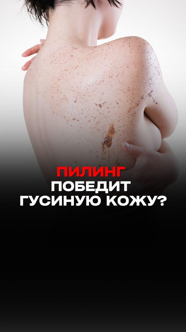 ПИЛИНГ ПОБЕДИТ ГУСИНУЮ КОЖУ?