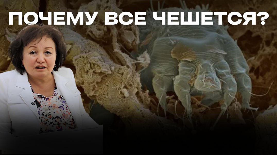 ПОЧЕМУ ВСЕ ЧЕШЕТСЯ?